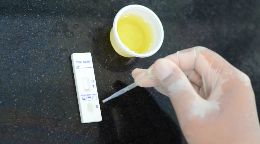 Image of an at-home drug test kit used for substance use
